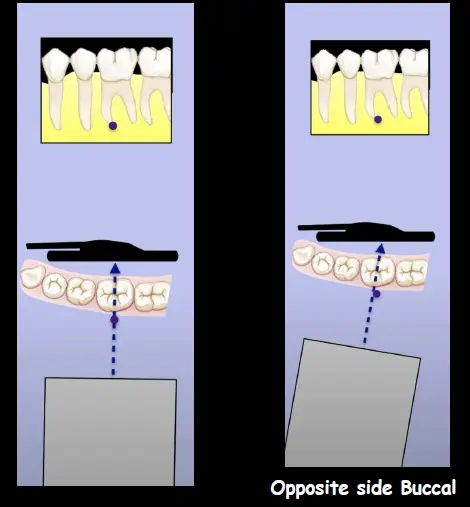 Endodontic Radiography and Working length determination-1764861593774.webp