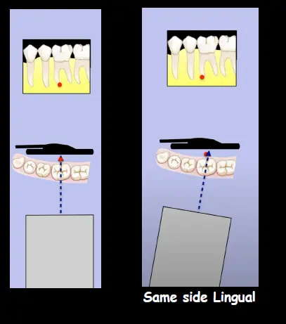 Endodontic Radiography and Working length determination-1764861603743.webp