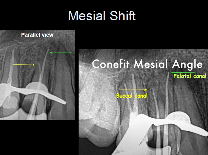 Endodontic Radiography and Working length determination-1764861853451.webp