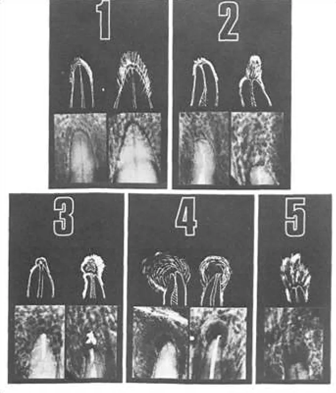 Endodontic Radiography and Working length determination-1764862434008.webp431x504