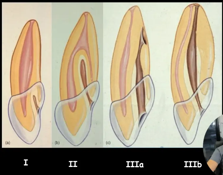 Endodontic Radiography and Working length determination-1764863204626.webp407x318