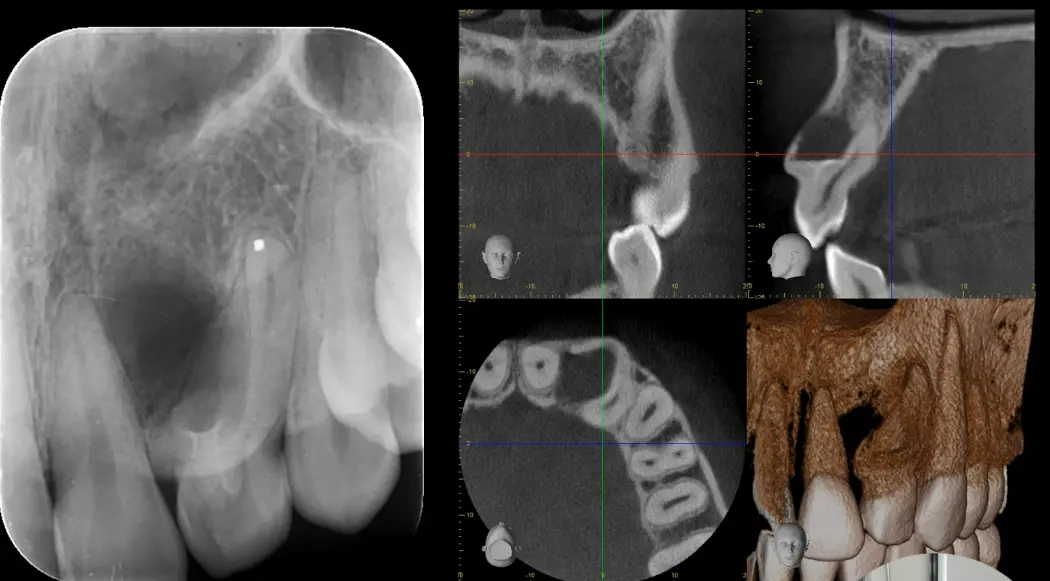 Endodontic Radiography and Working length determination-1764863214306.webp408x226