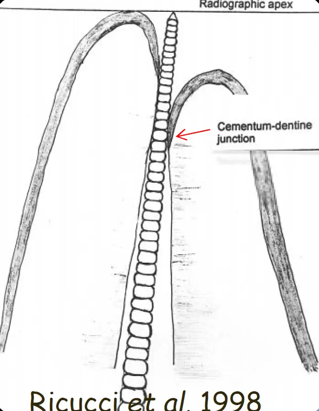 Endodontic Radiography and Working length determination-1764864779949.webp195x252