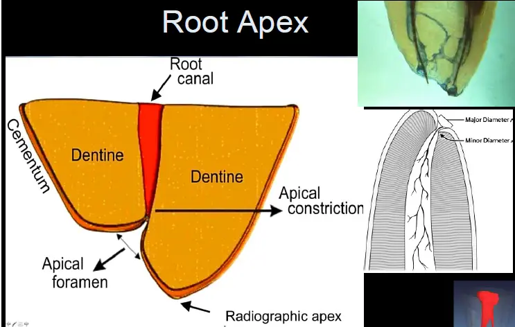 Endodontic Radiography and Working length determination-1764864807830.webp481x306