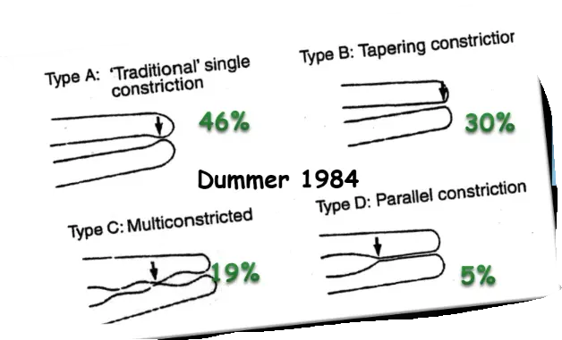 Endodontic Radiography and Working length determination-1764864963529.webp