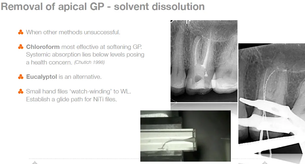 Endodontic Retreatment Case Selection & Procedures-1765439227195.webp