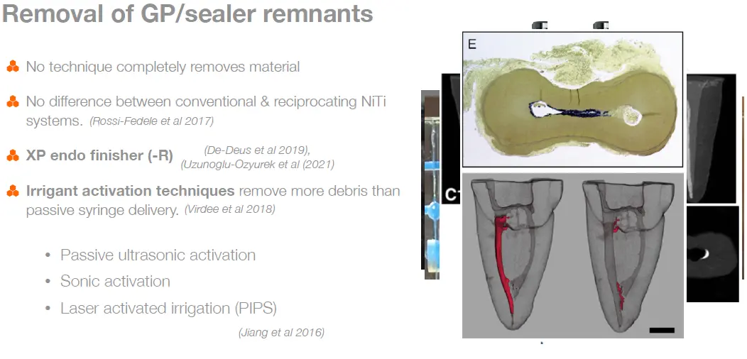 Endodontic Retreatment Case Selection & Procedures-1765439249537.webp