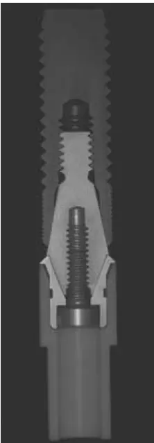 Implants-1781438853938.webp