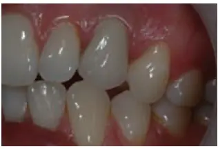 Implants-1781439709238.webp