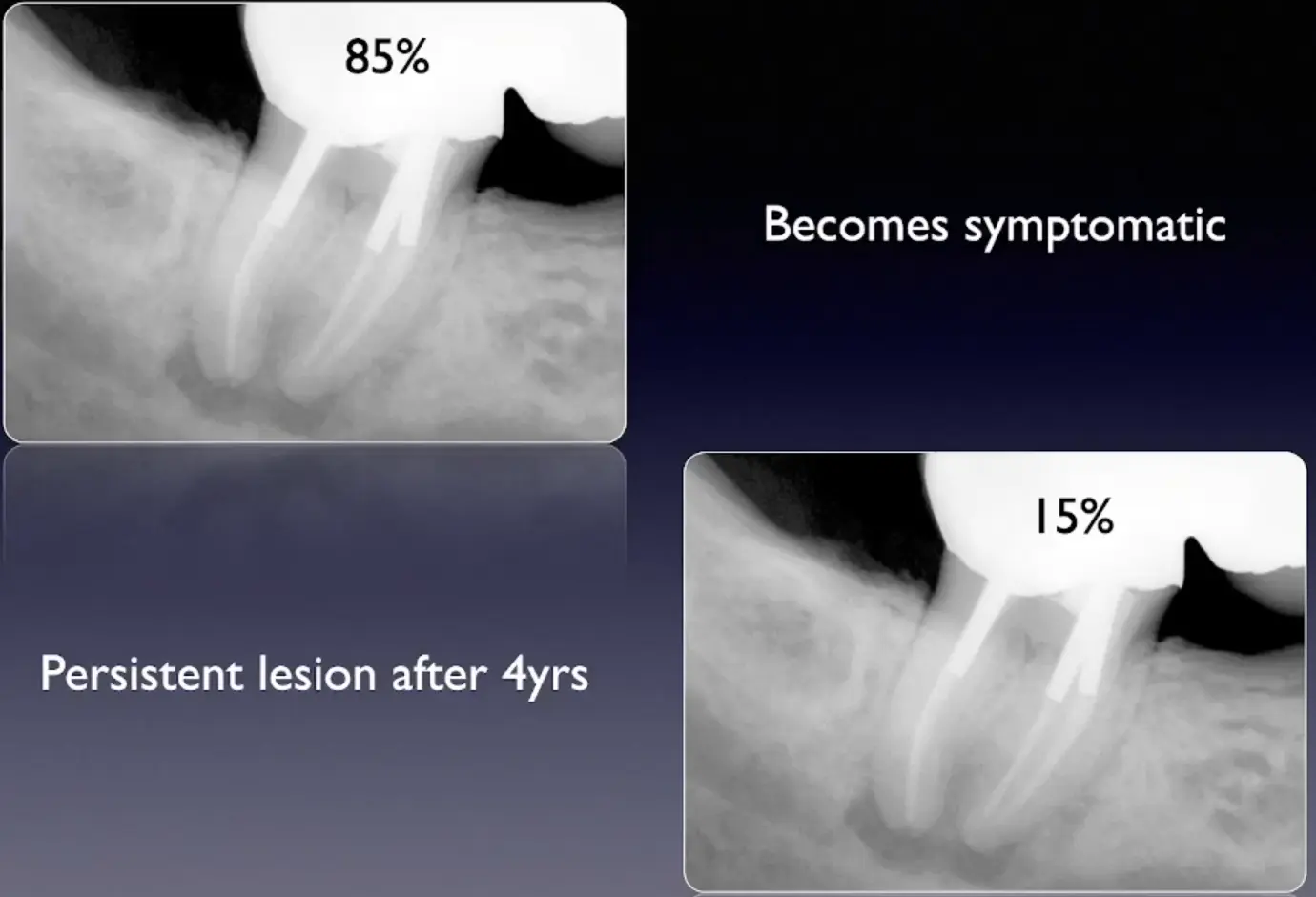 Introduction to Surgical Endodontics-1765445094766.webp