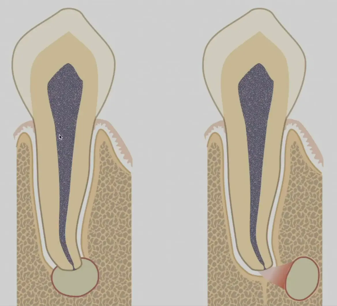 Introduction to Surgical Endodontics-1765445175495.webp559x508