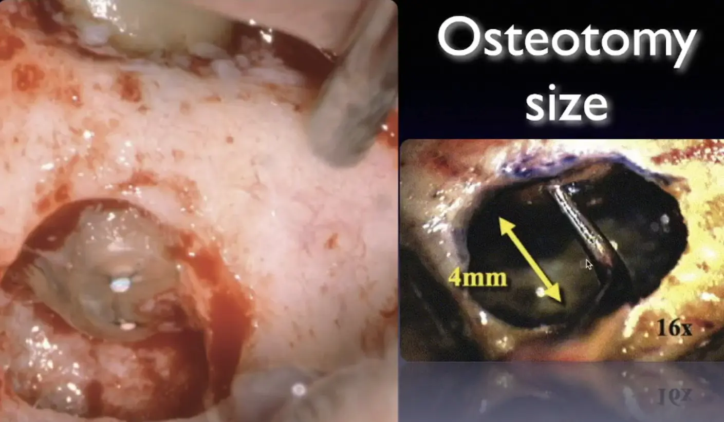 Introduction to Surgical Endodontics-1765445530917.webp