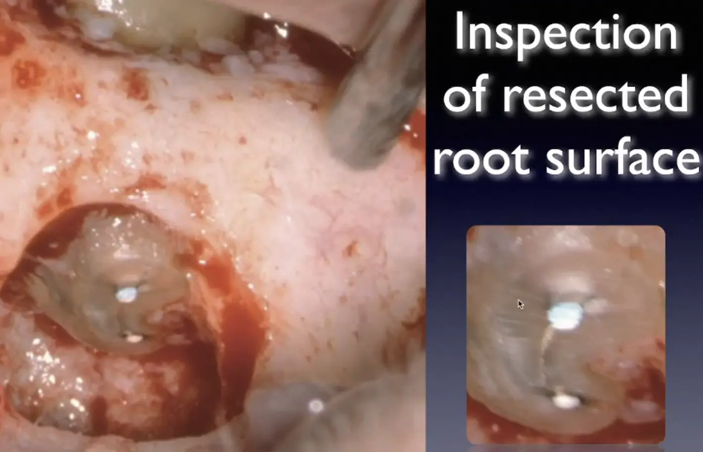 Introduction to Surgical Endodontics-1765445580720.webp