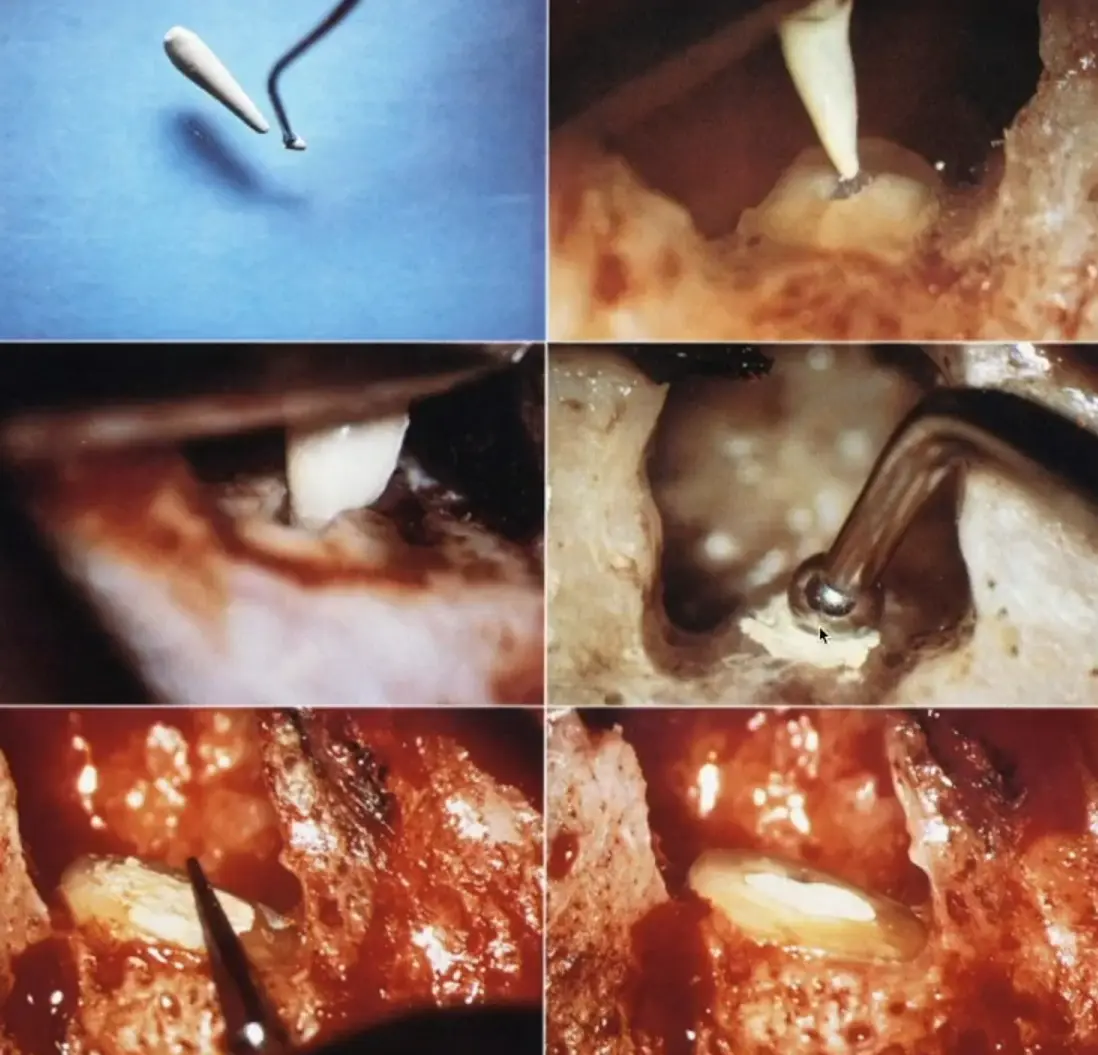 Introduction to Surgical Endodontics-1765445693618.webp