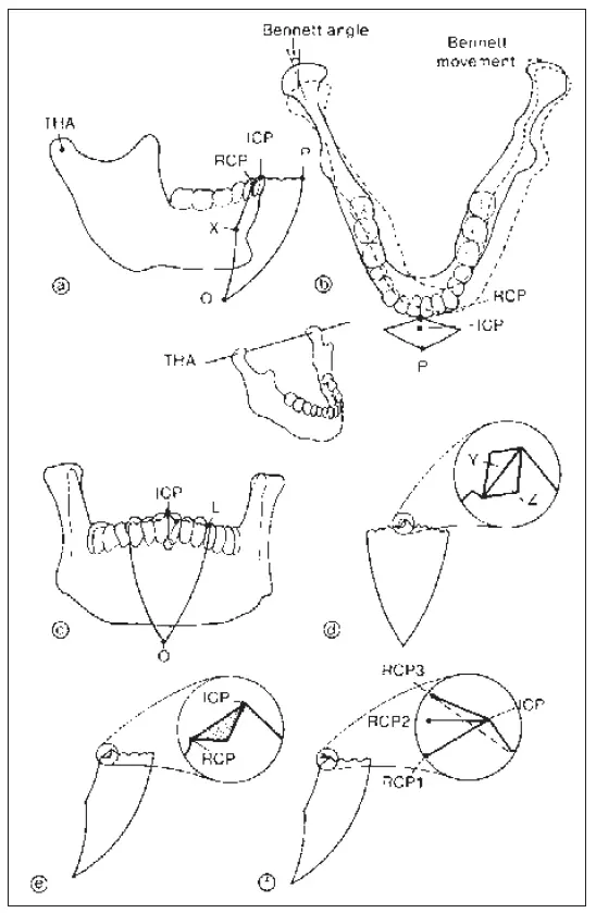 Occlusion-1780666638911.webp