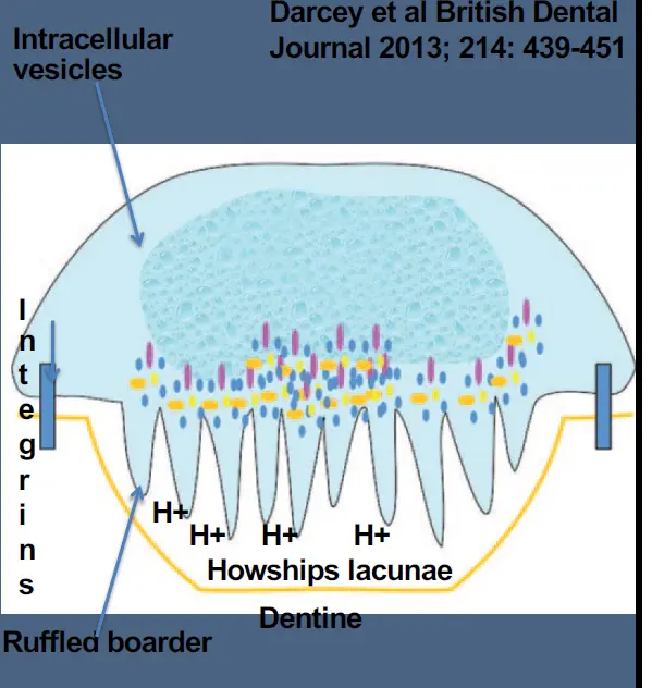 Pathological Tooth Resorption-1765494524836.webp