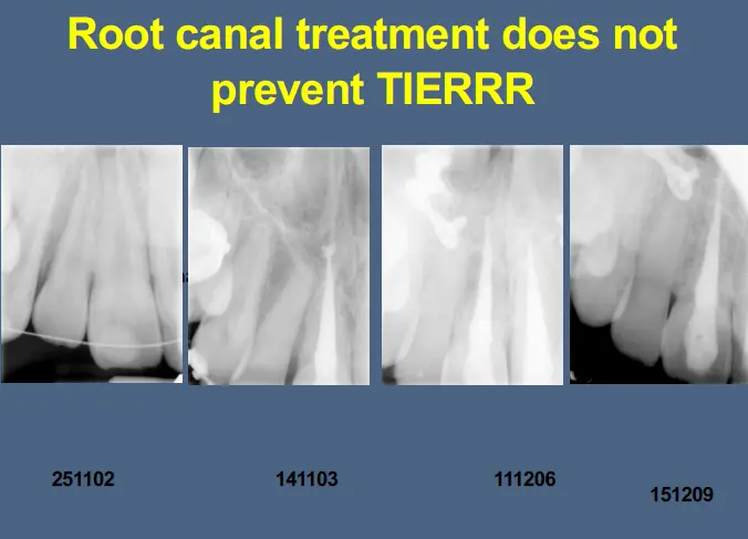 Pathological Tooth Resorption-1765515175946.webp