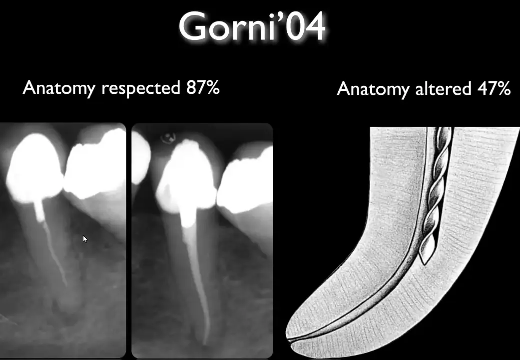 Prognosis, recall, evaluation of endodontic treatment outcomes-1765106658271.webp566x393