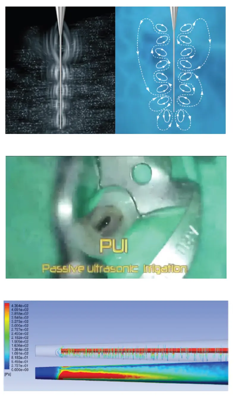 Root Canal Obturation-1764902204760.webp198x337