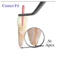 Root Canal Obturation-1764915420135.webp156x150