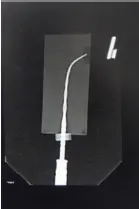 Root Canal Obturation-1764915519068.webp100x150
