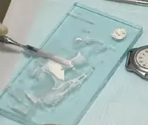 Root Canal Obturation-1764915537516.webp