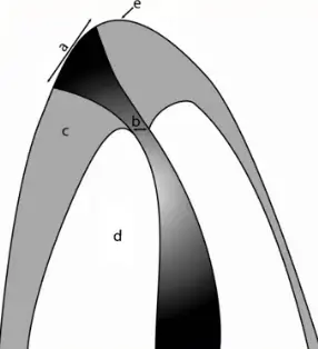 Root canal mechanical instrumentation 1, working length, glide path, hand instrumentation methods (step-back, modified crown-down)-1764889690073.webp