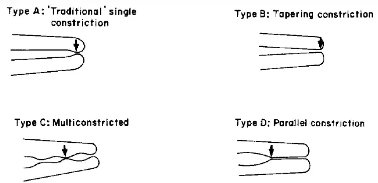 Root canal mechanical instrumentation 1, working length, glide path, hand instrumentation methods (step-back, modified crown-down)-1764889769604.webp