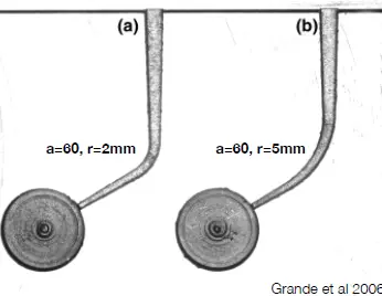 Root canal mechanical instrumentation 2, rotary canal preparation methods-1764893542320.webp246x191