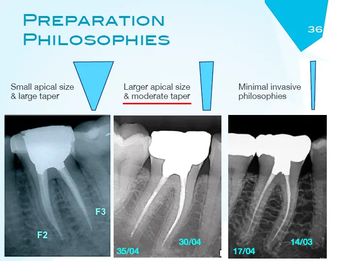 Root canal mechanical instrumentation 2, rotary canal preparation methods-1764893776426.webp
