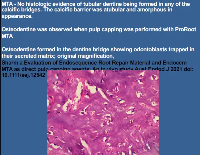 Vital Pulp Therapy-1765176602482.webp487x377