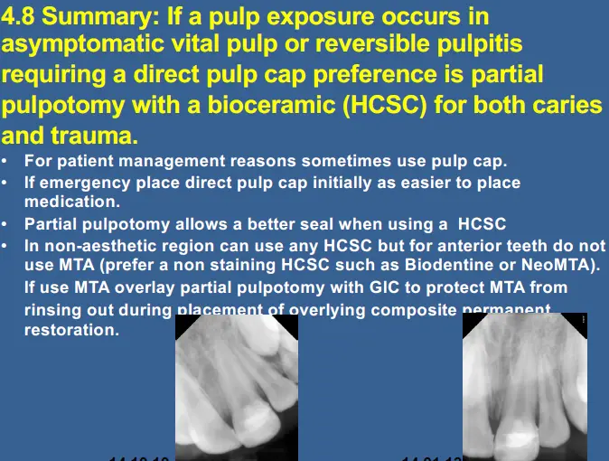 Vital Pulp Therapy-1765177386472.webp499x378